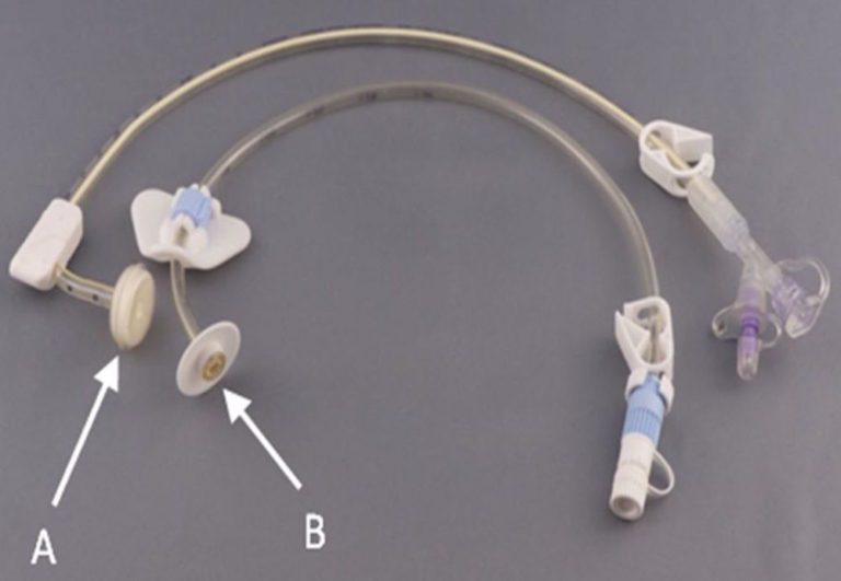 ΣΩΛΗΝΕΣ ΓΑΣΤΡΟΣΤΟΜΙΑΣ