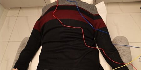 Ηλεκτροβελονισμος για κνησμο Ηλεκτροβελονισμος για κνησμο