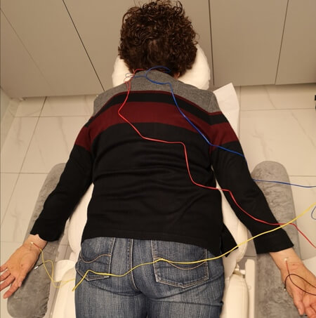 Ηλεκτροβελονισμος για κνησμο